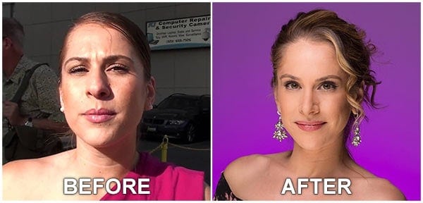 The Young Turks Ana Kasparian before and after nose job.